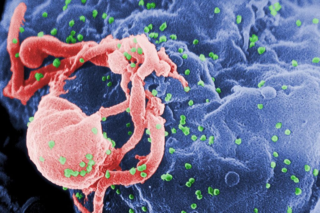 1024px-HIV-budding-Color