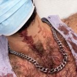 gay, spain, attack, hammer