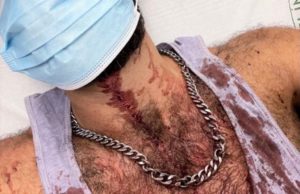 gay, spain, attack, hammer