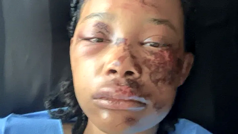 Amylah Majors - Photo via GoFundMe