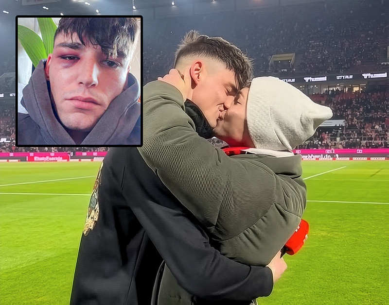 Out German Referee Assaulted After Viral Proposal to Boyfriend
